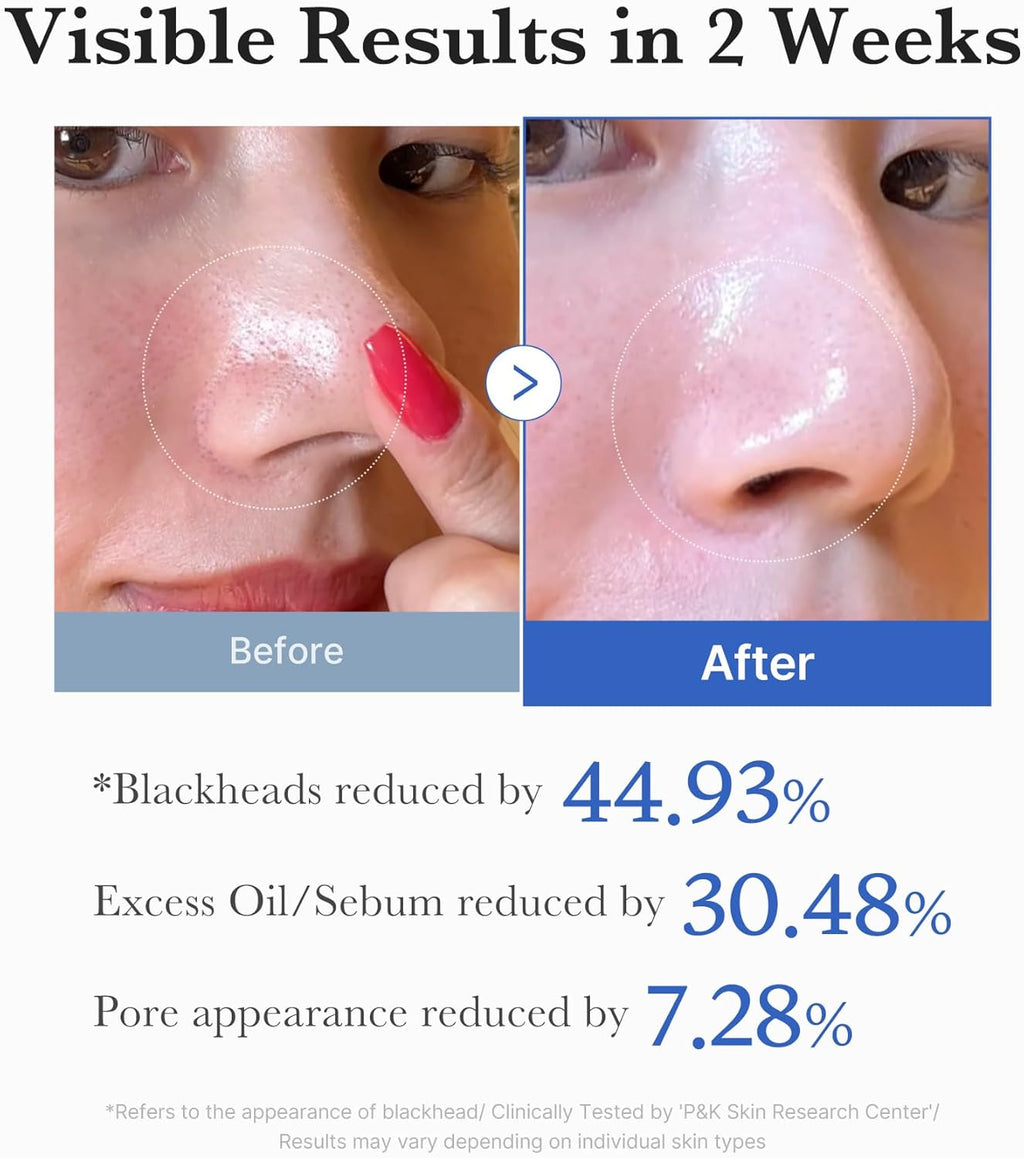 medicube Zero Pore Pad 2.0 – Exfoliating Toner Pads
