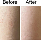 The INKEY List Glycolic Acid Exfoliating Body Stick 45g